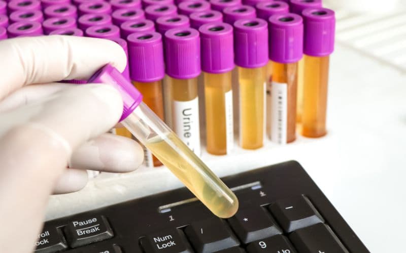 varios tubos de laboratorios